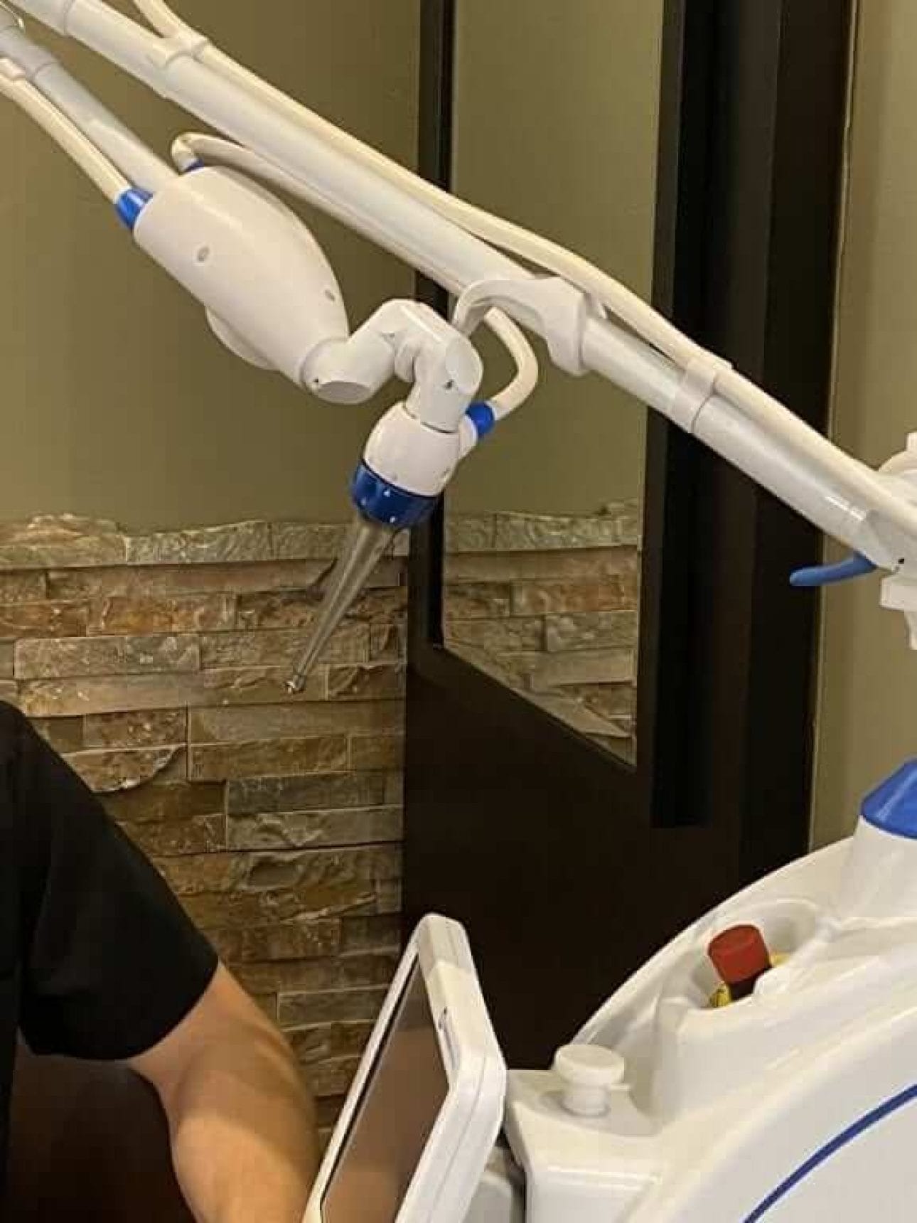 Dr. Mark Phillipe Uses the Solea Laser for Frenectomies on Babies, Teens and Adults.