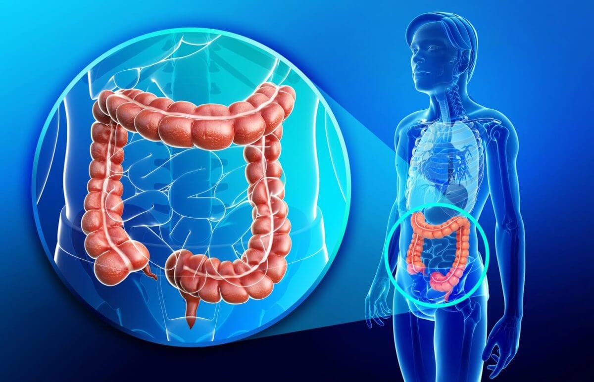 The Body's Colon and How Fusobacterium Nucleatum Might be Connected to Colon Cancer.
