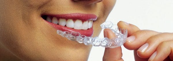 Invisalign Treatment for Malocclusions