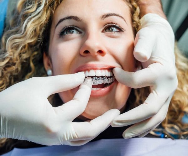 Invisalign Underbite Correction Invisalign Underbite Correction