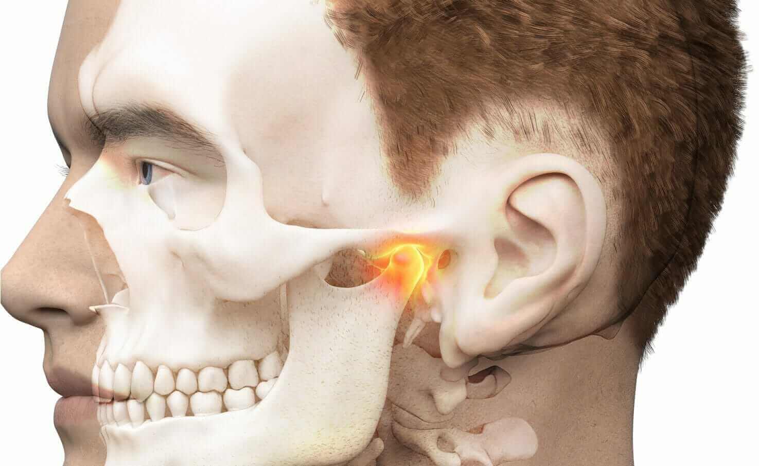 TMJ pain relief and Location